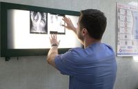 У Рівному безплатно роблять унікальні операції з вирівнення хребта