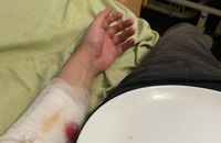 Закарпатський ТЦК прокоментував спробу самогубства в його приміщенні 27-річного киянина