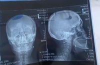 На Волині людолови з ТЦК вистрілили в голову пенсіонерці